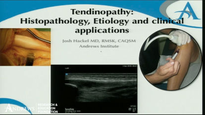 Picture of Tendinopathy